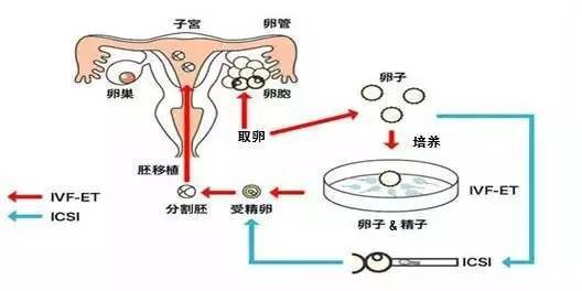 助孕生子