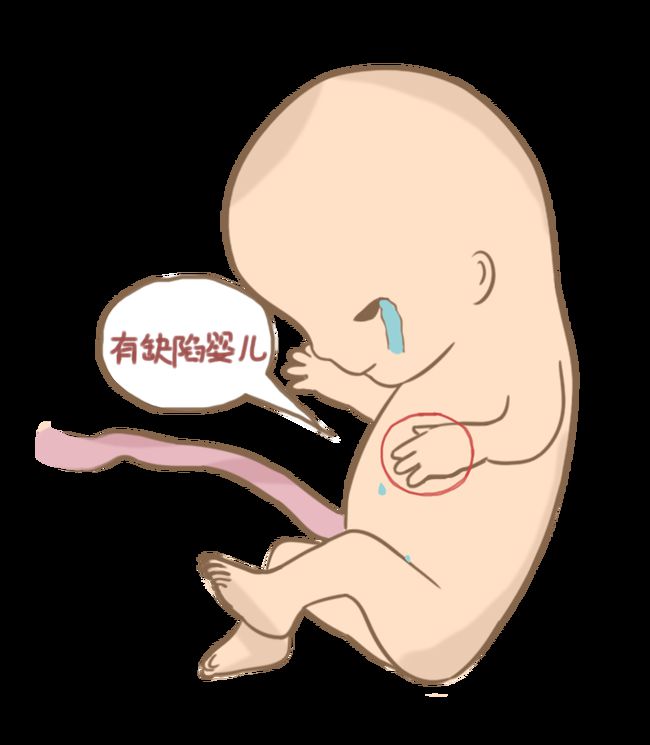 助孕