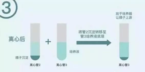 助孕公司