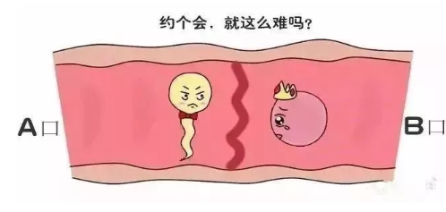 试管婴儿