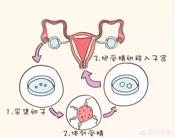 东莞助孕