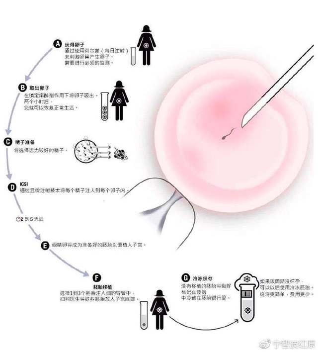 嘉兴试管婴儿
