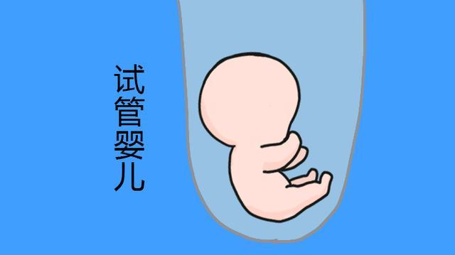 器官移植